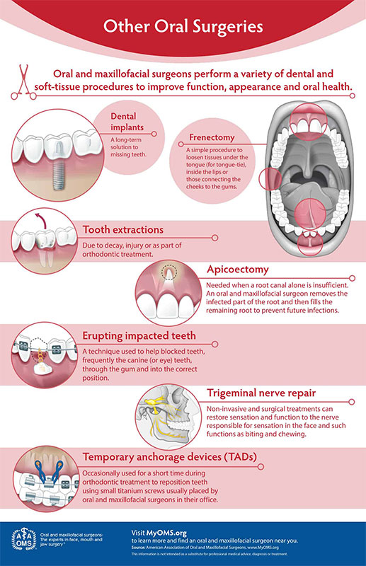 other_surgeries_infographic-1