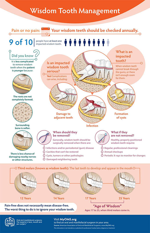 Wisdom Teeth Management infographic