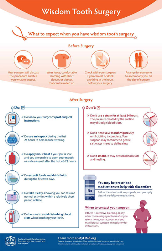 Wisdom Teeth Surgery infographic